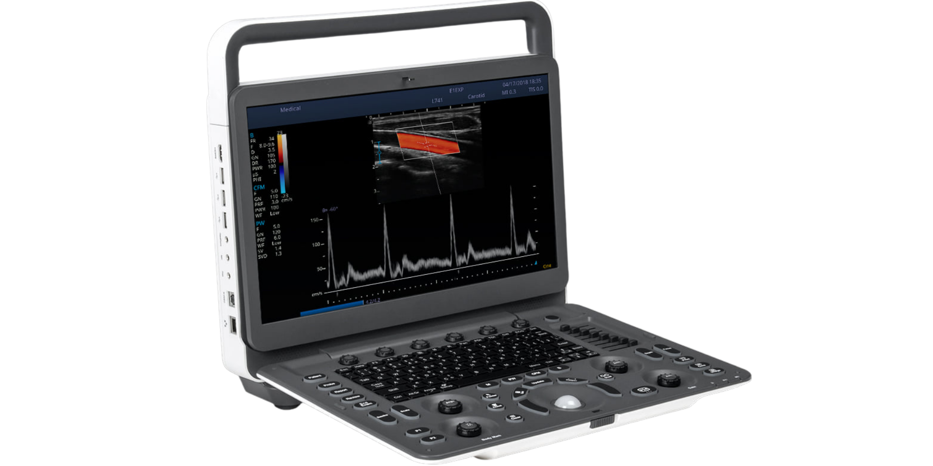 SONOSCAPE E1 EXP, EL ECOGRAFO PORTATIL MAS VENDIDO EN BOLIVIA 