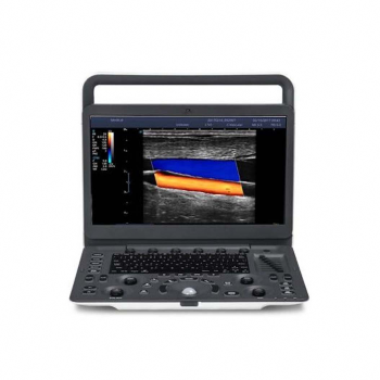 ECOGRAFO PORTATIL SONOSCAPE E1 EXP VETERINARIO