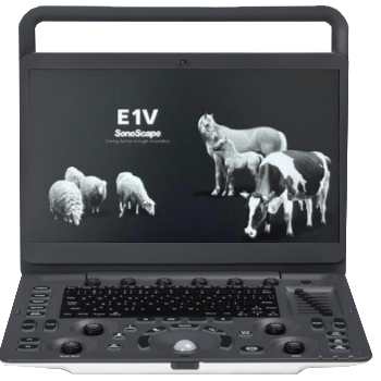 ECOGRAFO PORTATIL E1V