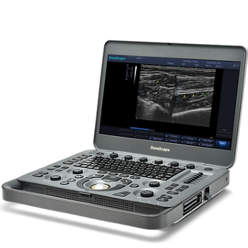 ECOGRAFO PORTATIL SONOSCAPE X3