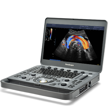 ECOGRAFO PORTATIL SONOSCAPE X3V