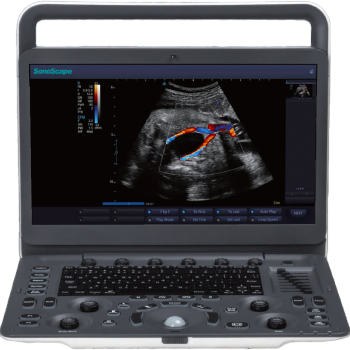 Ecografo Veterinario E2V