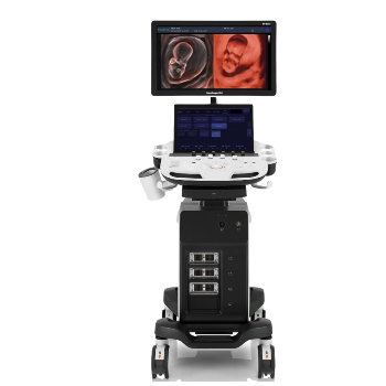 SONOSCAPE P9 ELITE SISTEMA ESTACIONARIO DE ULTRASONIDO DOPPLER COLOR DIAGNÓSTICO