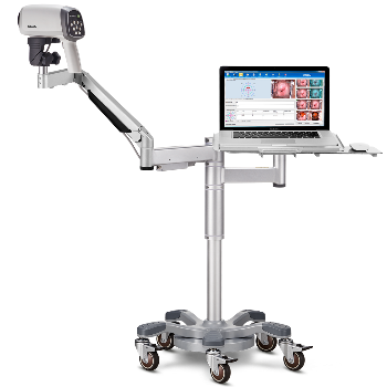 VIDEO COLPOSCOPIO C6A